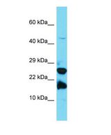 Western blot of A2LD1 Antibody - N-terminal region with human Jurkat cells lysate.