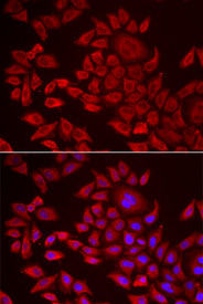 Immunofluorescence analysis of HeLa cell using AGPAT2 antibody. Blue: DAPI for nuclear staining.