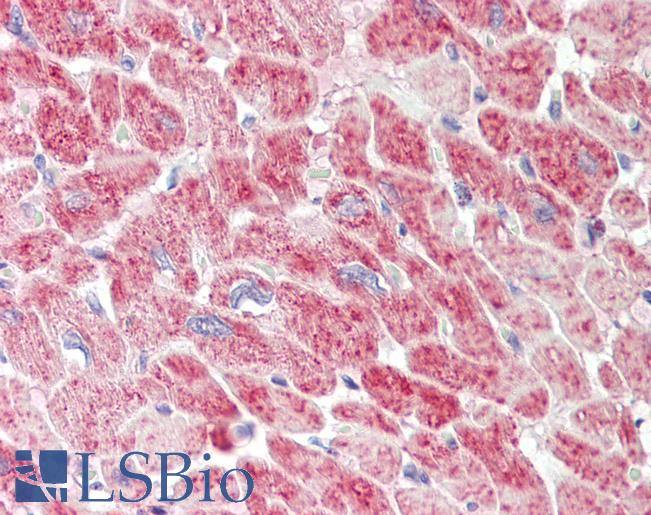 Human Heart: Formalin-Fixed, Paraffin-Embedded (FFPE)