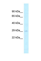 AGPAT2 antibody western blot of 721_B Cell lysate. Antibody concentration 1 ug/ml.