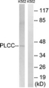 Western blot of extracts from K562 cells, using AGPAT3 Antibody. The lane on the right is treated with the synthesized peptide.
