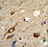Formalin-fixed and paraffin-embedded human brain tissue reacted with AGPAT3 Antibody , which was peroxidase-conjugated to the secondary antibody, followed by DAB staining. This data demonstrates the use of this antibody for immunohistochemistry; clinical relevance has not been evaluated.