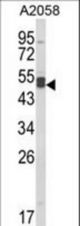 Western blot of AGPAT3 Antibody in A2058 cell line lysates (35 ug/lane). AGPAT3 (arrow) was detected using the purified antibody.