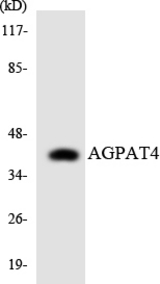 Western blot of the lysates from HeLa cells using AGPAT4 antibody.