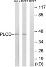 Western blot of extracts from HeLa/MCF-7 cells, using AGPAT4 Antibody. The lane on the right is treated with the synthesized peptide.