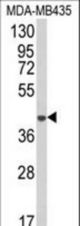 Western blot of AGPAT4 Antibody in MDA-MB435 cell line lysates (35 ug/lane). AGPAT4 (arrow) was detected using the purified antibody.