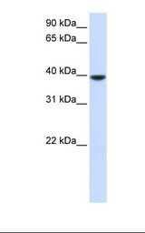 Fetal muscle lysate. Antibody concentration: 1.0 ug/ml. Gel concentration: 12%.
