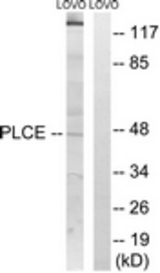Western blot of extracts from LOVO cells, using AGPAT5 Antibody. The lane on the right is treated with the synthesized peptide.