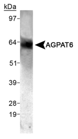 Detection of AGPAT6 in mouse skeletal muscle.