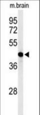 Western blot of AGPAT6 Antibody in mouse brain tissue lysates (35 ug/lane). AGPAT6 (arrow) was detected using the purified antibody.
