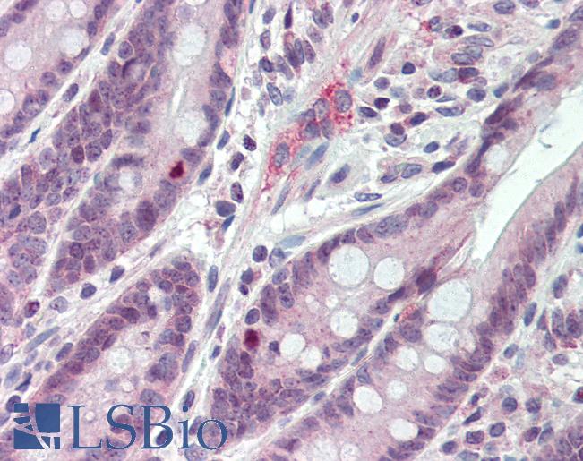 Anti-AGPAT6 antibody IHC of human small intestine. Immunohistochemistry of formalin-fixed, paraffin-embedded tissue after heat-induced antigen retrieval. Antibody LS-B2305 concentration 20 ug/ml.