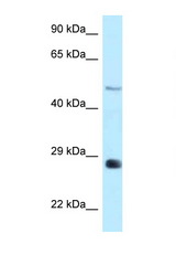 AGPAT9 antibody LS-C146143 Western blot of Rat Brain lysate. Antibody concentration 1 ug/ml.