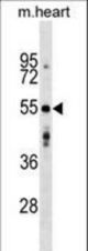 AGPAT9 Antibody western blot of mouse heart tissue lysates (35 ug/lane). The AGPAT9 antibody detected the AGPAT9 protein (arrow).
