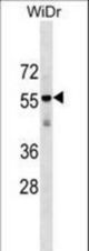 AGPAT9 Antibody western blot of WiDr cell line lysates (35 ug/lane). The AGPAT9 antibody detected the AGPAT9 protein (arrow).