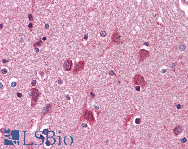 Anti-AGPS antibody IHC of human brain, cortex. Immunohistochemistry of formalin-fixed, paraffin-embedded tissue after heat-induced antigen retrieval. Antibody LS-B4204 concentration 10 ug/ml.