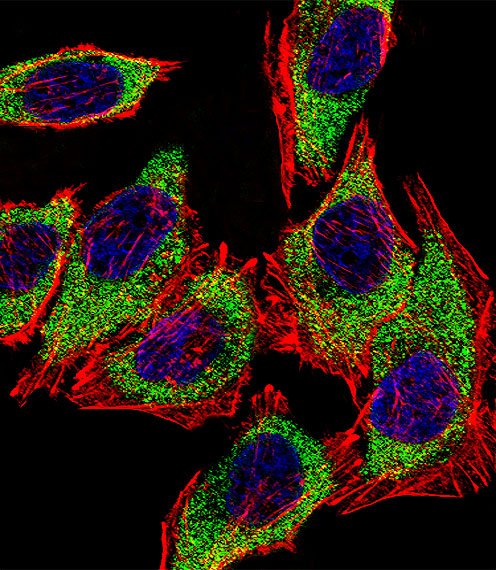 Fluorescent confocal image of A549 cell stained with AGR2 Antibody. A549 cells were fixed with 4% PFA (20 min), permeabilized with Triton X-100 (0.1%, 10 min), then incubated with AGR2 primary antibody (1:25, 1 h at 37°C). For secondary antibody, Alexa Fluor 488 conjugated donkey anti-rabbit antibody (green) was used (1:400, 50 min at 37°C). Cytoplasmic actin was counterstained with Alexa Fluor 555 (red) conjugated Phalloidin (7units/ml, 1 h at 37°C). Nuclei were counterstained with DAPI (blue) (10 ug/ml, 10 min). AGR2 immunoreactivity is localized to Cytoplasm significantly.