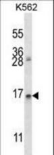 AGR2 Antibody western blot of K562 cell line lysates (35 ug/lane). The AGR2 antibody detected the AGR2 protein (arrow).