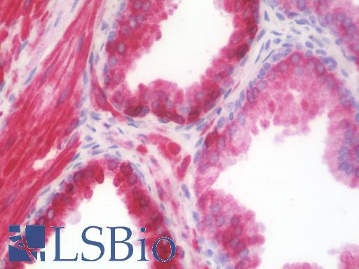 Anti-AGR2 antibody IHC staining of human prostate. Immunohistochemistry of formalin-fixed, paraffin-embedded tissue after heat-induced antigen retrieval. Antibody LS-B10084 concentration 10 ug/ml.