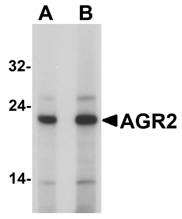 Western blot analysis of AGR2 in HeLa cell lysate with AGR2 antibody at (A) 1 and (B) 2 ug/ml