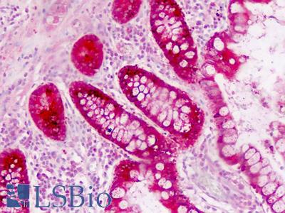 Human Small Intestine: Formalin-Fixed, Paraffin-Embedded (FFPE)