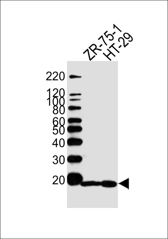 Western blot of lysates from ZR-75-1, HT29 cell line (from left to right), using AGR2 Antibody. Antibody was diluted at 1:1000 at each lane. A goat anti-rabbit IgG H&L (HRP) at 1:5000 dilution was used as the secondary antibody. Lysates at 35ug per lane.