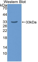 Western blot of recombinant AGRN / Agrin.