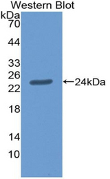Western blot of recombinant AGRN / Agrin.