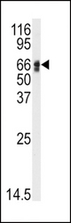 Western blot of anti-AGT Antibody in HepG2 cell line lysates (35 ug/lane). AGT(arrow) was detected using the purified antibody.