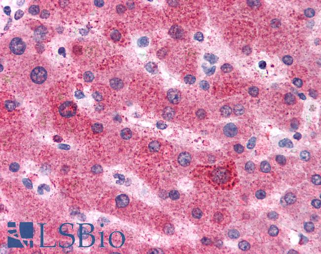 Anti-AGT / Angiotensinogen antibody LS-A9701 IHC of human liver. Immunohistochemistry of formalin-fixed, paraffin-embedded tissue after heat-induced antigen retrieval.