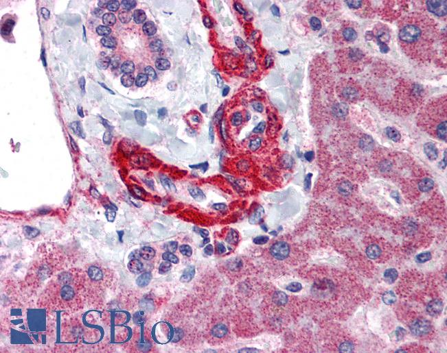 Anti-AGT / Angiotensinogen antibody LS-A9700 IHC of human liver. Immunohistochemistry of formalin-fixed, paraffin-embedded tissue after heat-induced antigen retrieval.
