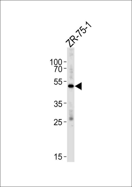 AGTR1 Antibody (Y319) western blot of ZR-75-1 cell line lysates (35 ug/lane). The AGTR1 antibody detected the AGTR1 protein (arrow).