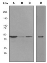 Western blot analysis on (A) HepG2, (B) 293T, (C) HeLa and (D) fetal liver lysates using anti-Type-2 Angiotensin II receptor antibody (LS-C105738).