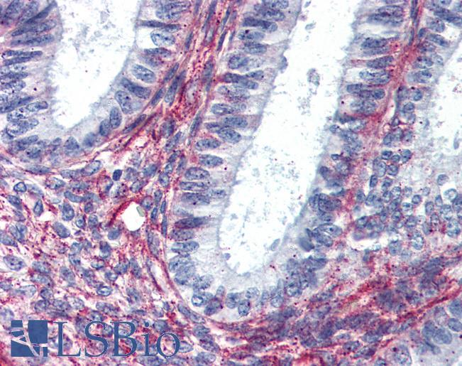 Anti-AGTR2 antibody LS-A1322 IHC of human uterus. Immunohistochemistry of formalin-fixed, paraffin-embedded tissue after heat-induced antigen retrieval.