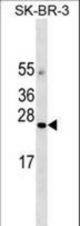 AGTRAP Antibody western blot of SK-BR-3 cell line lysates (35 ug/lane). The AGTRAP Antibody detected the AGTRAP protein (arrow).