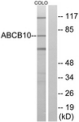 Western blot of extracts from COLO cells, using ABCB10 Antibody. The lane on the right is treated with the synthesized peptide.