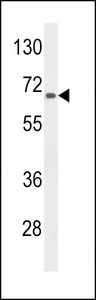 Western blot of lysate from HepG2 cell line, using AGXT2 Antibody. Antibody was diluted at 1:1000 at each lane. A goat anti-rabbit IgG H&L (HRP) at 1:5000 dilution was used as the secondary antibody. Lysate at 35ug per lane.