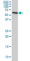 AHCYL1 monoclonal antibody (M05), clone 5D6 Western blot of AHCYL1 expression in HeLa.