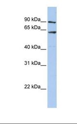 Placenta lysate. Antibody concentration: 1.0 ug/ml. Gel concentration: 12%.