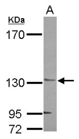 Sample (30 ug of whole cell lysate) A: NT2D1 7.5% SDS PAGE AHI1 antibody diluted at 1:1000