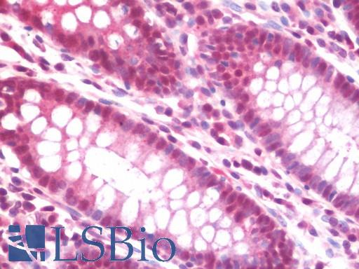 Anti-AHI1 antibody IHC staining of human colon. Immunohistochemistry of formalin-fixed, paraffin-embedded tissue after heat-induced antigen retrieval. Antibody LS-B11009 concentration 5 ug/ml.