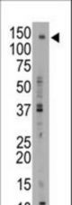 The anti-ABCB11 C-term antibody is used in Western blot to detect ABCB11 in mouse liver tissue lysate.