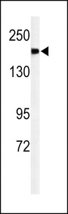 Western blot of A2ML1 Antibody in mouse lung tissue lysates (35 ug/lane). A2ML1 (arrow) was detected using the purified antibody.