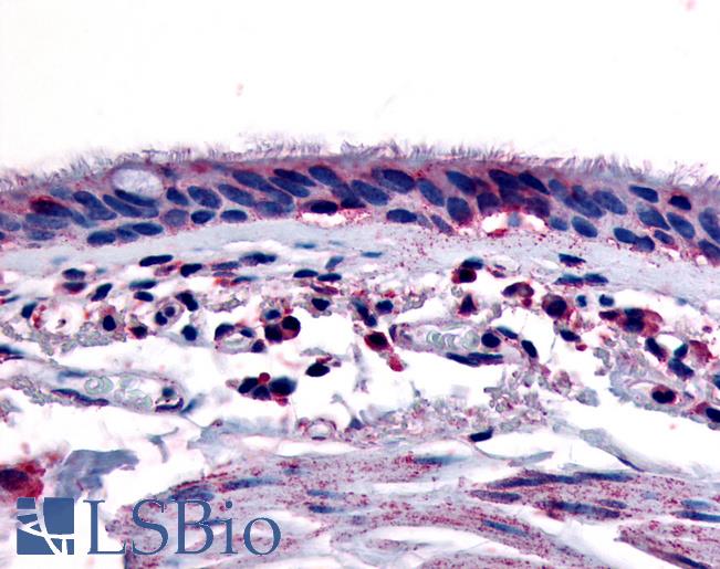 Anti-Aryl Hydrocarbon Receptor antibody LS-A3018 IHC of human respiratory epithelium and bronchial smooth muscle. Immunohistochemistry of formalin-fixed, paraffin-embedded tissue after heat-induced antigen retrieval.