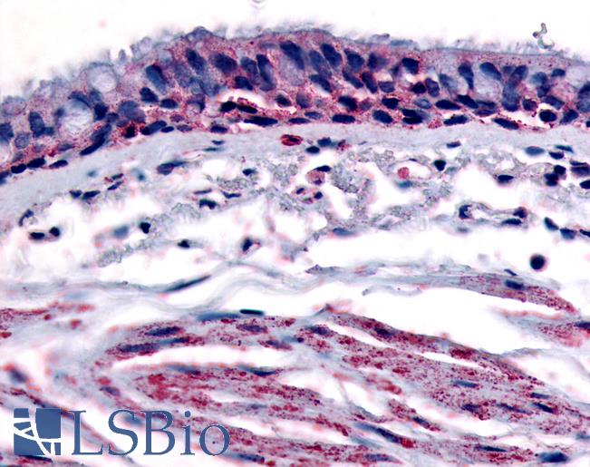 Anti-Aryl Hydrocarbon Receptor antibody LS-A3017 IHC of human respiratory epithelium and bronchial smooth muscle. Immunohistochemistry of formalin-fixed, paraffin-embedded tissue after heat-induced antigen retrieval.