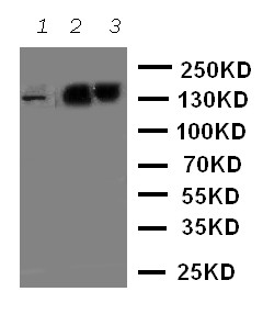 WB of ABCB11 / BSEP antibody. Lane 1: Rat Liver Tissue Lysate. Lane 2: SMMC Cell Lysate. Lane 3: M231 Cell Lysate.