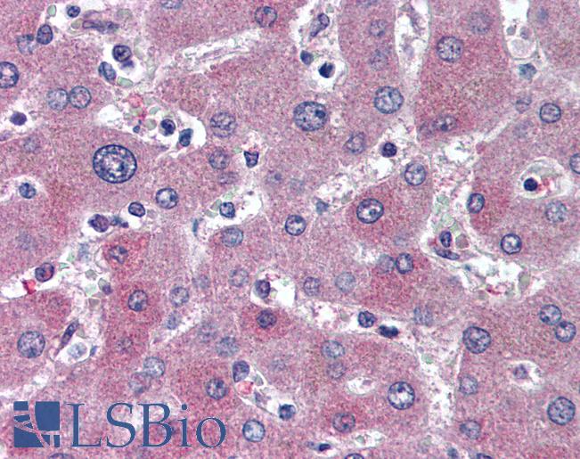 Anti-ABCB11 / BSEP antibody IHC of human liver. Immunohistochemistry of formalin-fixed, paraffin-embedded tissue after heat-induced antigen retrieval. Antibody LS-B2170 concentration 5 ug/ml.