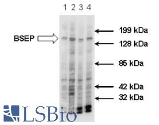 WB staining of crude plasma membrane purified from human liver tissue collected by fine needle biopsy.