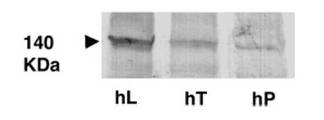Western blot of crude membranes isolated from human liver (hL), human.