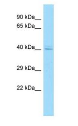 AHSA1 / AHA1 antibody Western Blot of MCF7.