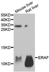Western blot analysis of extracts of various tissues, using AHSP antibody.
